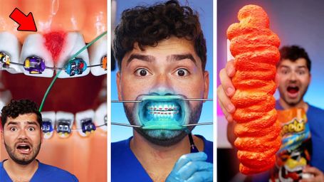 Which TikTok Will Break my Braces?
