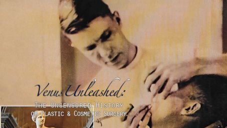Venus Unleashed: The Uncensored History of Plastic and Cosmetic Surgery