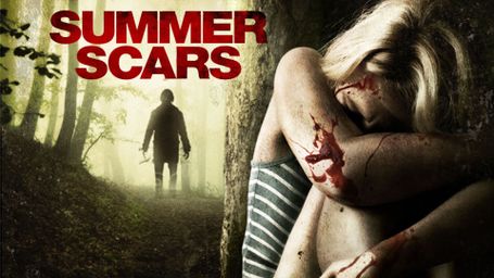 Summer Scars