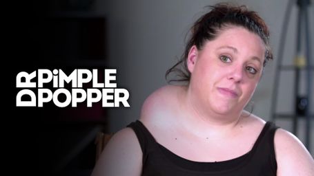 Dr. Pimple Popper