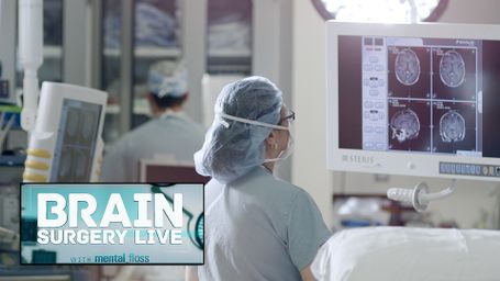 Brain Surgery Live with Mental Floss