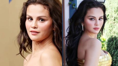 The Mystery Behind Selena Gomezs Changing Face (Emmys Look and More)