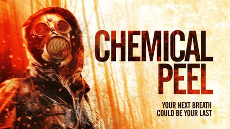 Chemical Peel