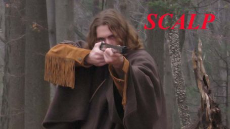 Scalp